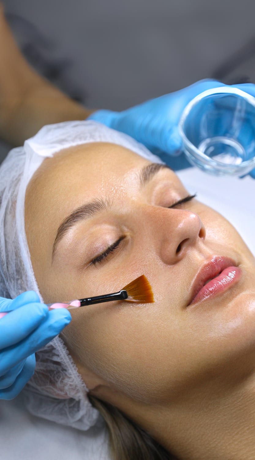 Chemical Peels